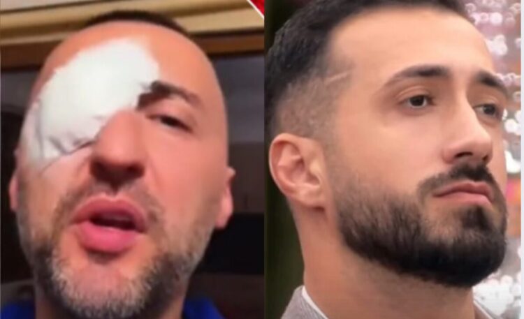 Thellohet skandali..."S*lmohet" edhe G Bani pasi i doli në mbështetje Gjestit!