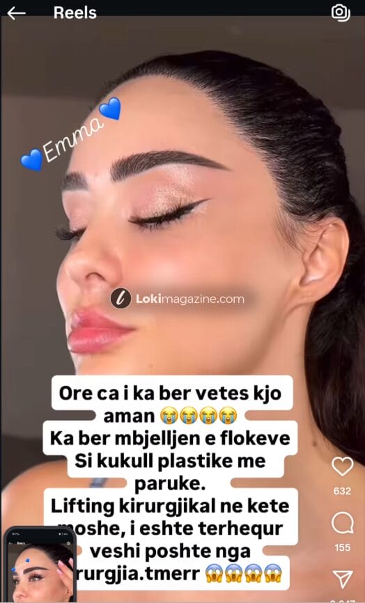 Cfarë ka ndodhur me flokët dhe kokën e Xhensila Myrtezajt? Shtanget rrjetin me dukjen e saj të fundit
